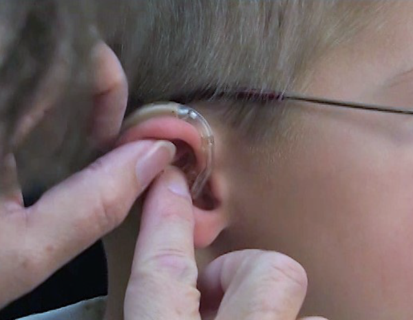 How to Insert and Remove the Earmold